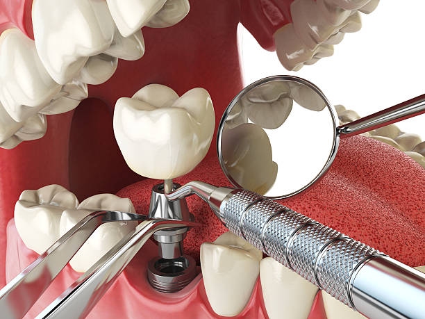 Best Cracked Tooth Emergency Dentist  in Winter Park, FL